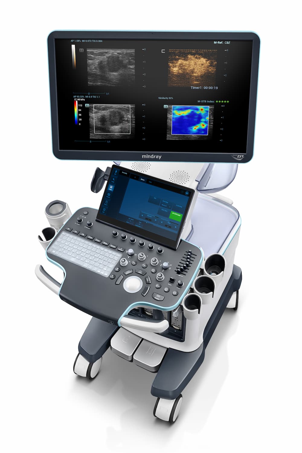 Resona Ultrasound Machine